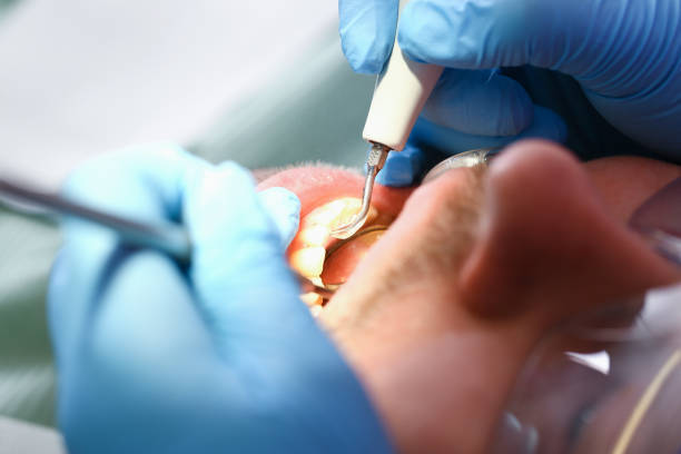 Best After-Hours Dental Care in Palmview South, TX